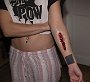 arm